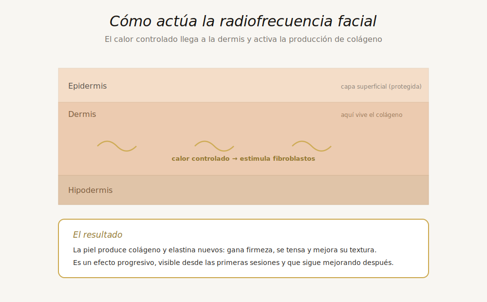 Diagrama de cómo la radiofrecuencia facial calienta la dermis y estimula la producción de colágeno